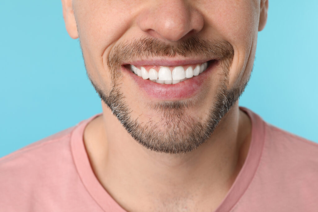Dental Impressions of Ankeny, IA offers bonding and contouring