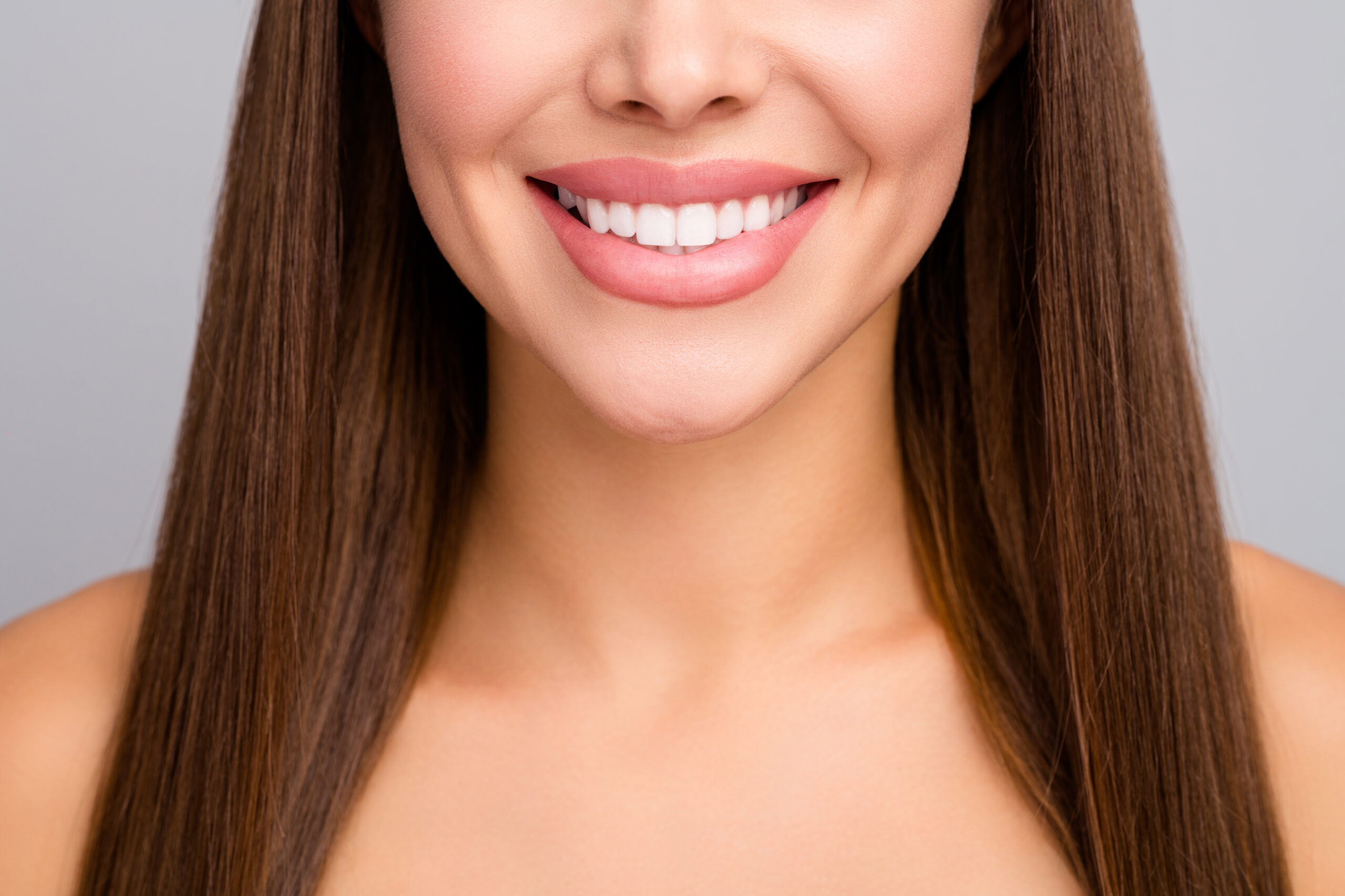 Dental Impressions Offers Veneers for a beautiful smile 