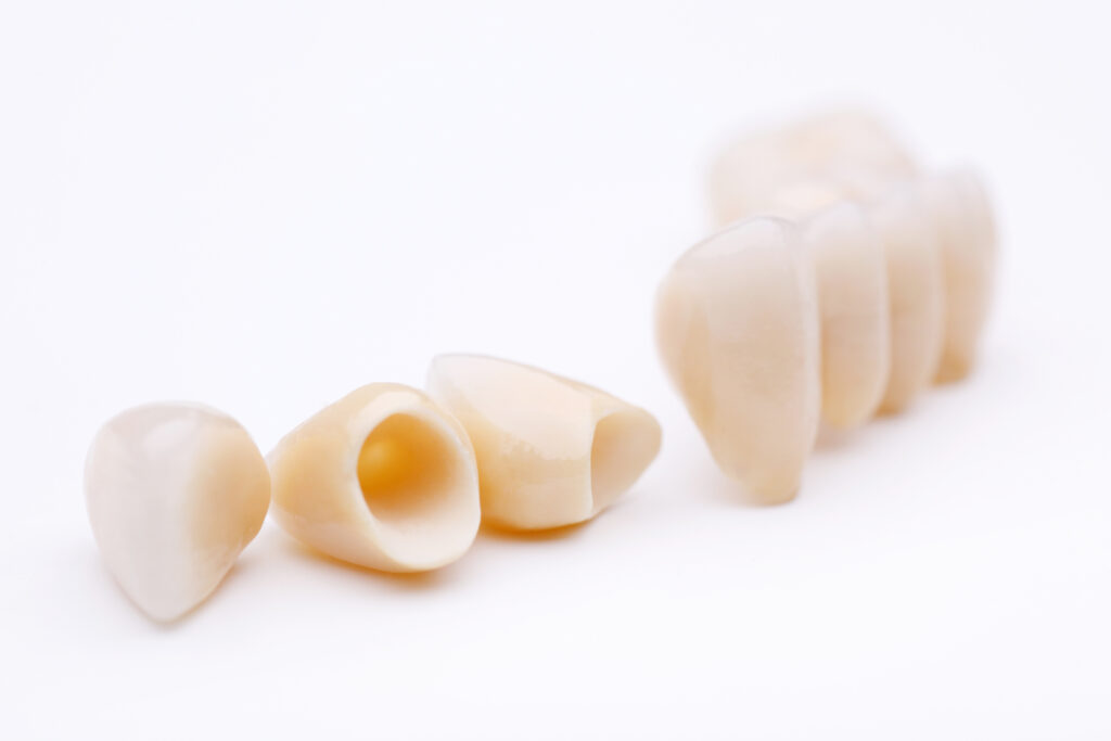 ankeny dental crowns