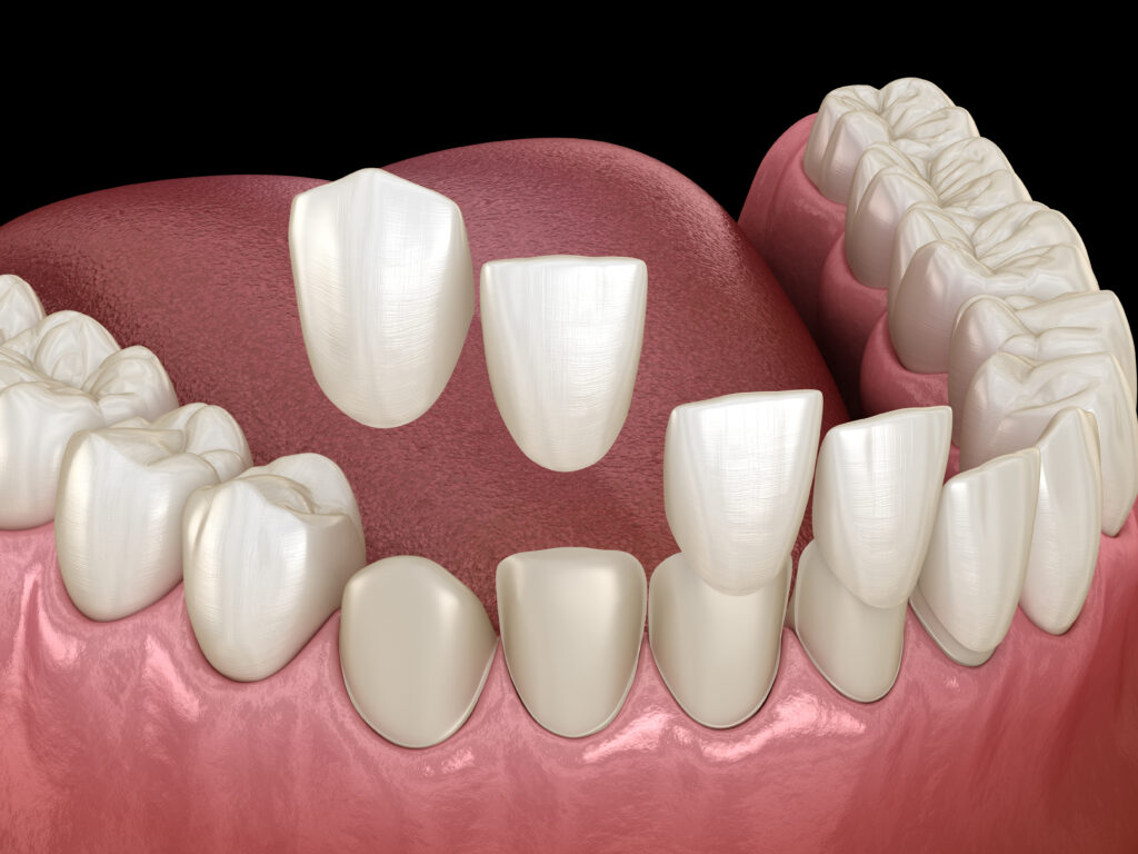 ankeny restorative dentistry