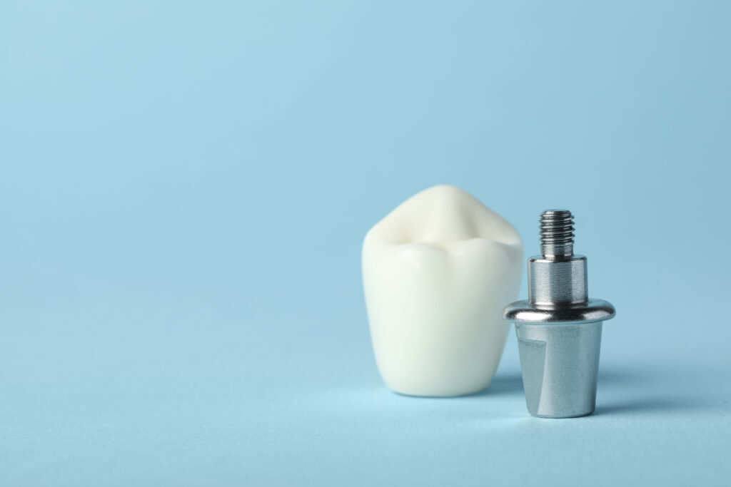 ankeny dental crowns