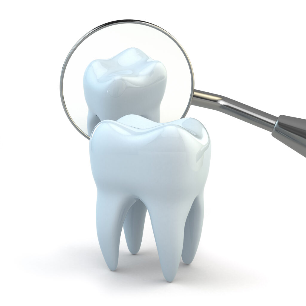 ankeny dental fillings