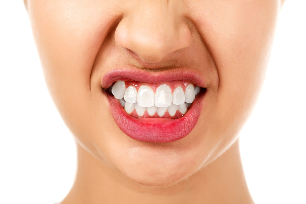 ankeny teeth grinding