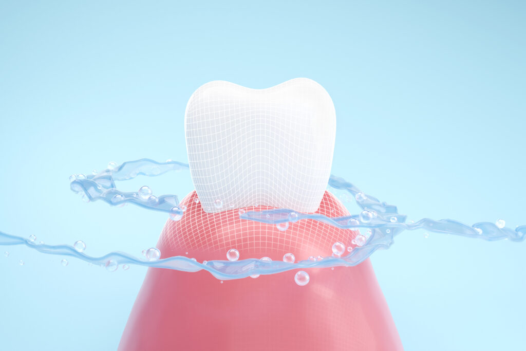 ankeny dental cleaning