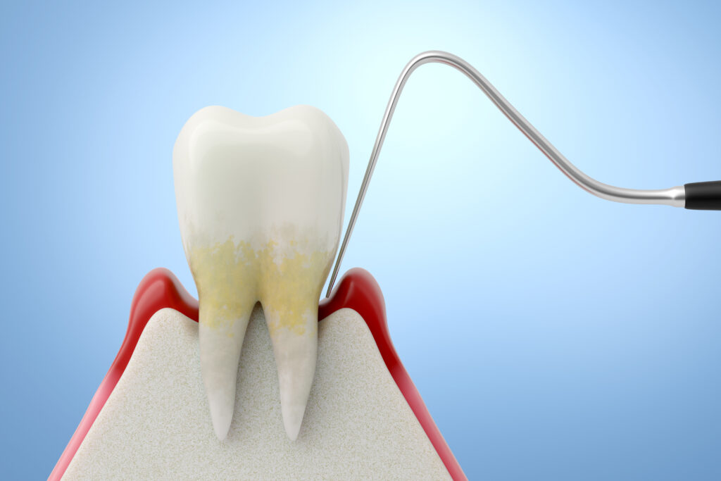 ankeny deep cleaning