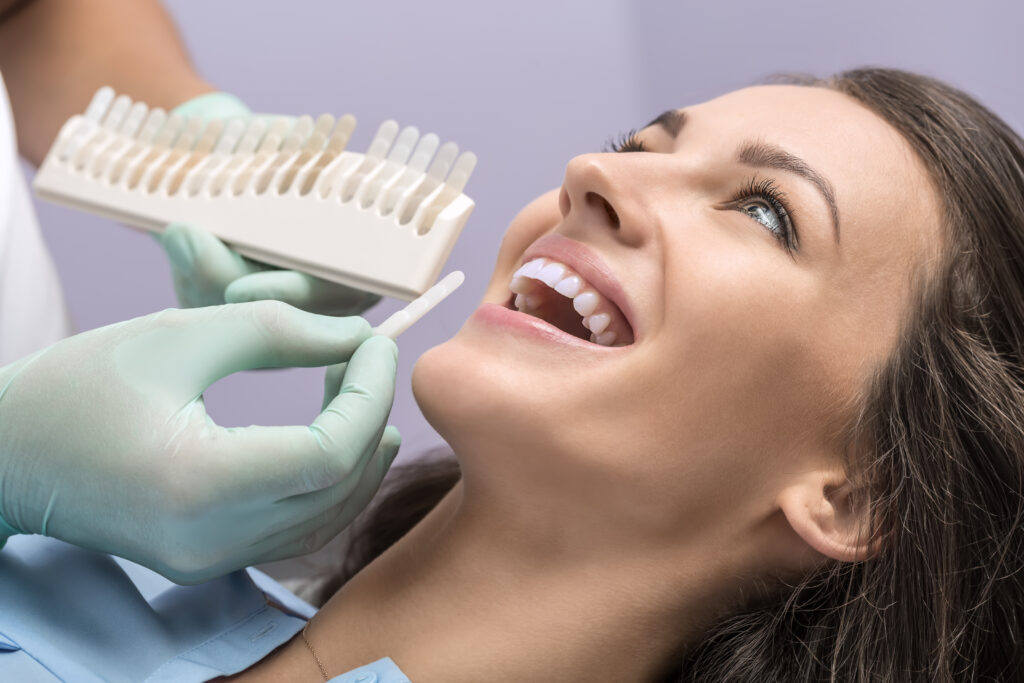 ankeny teeth stains