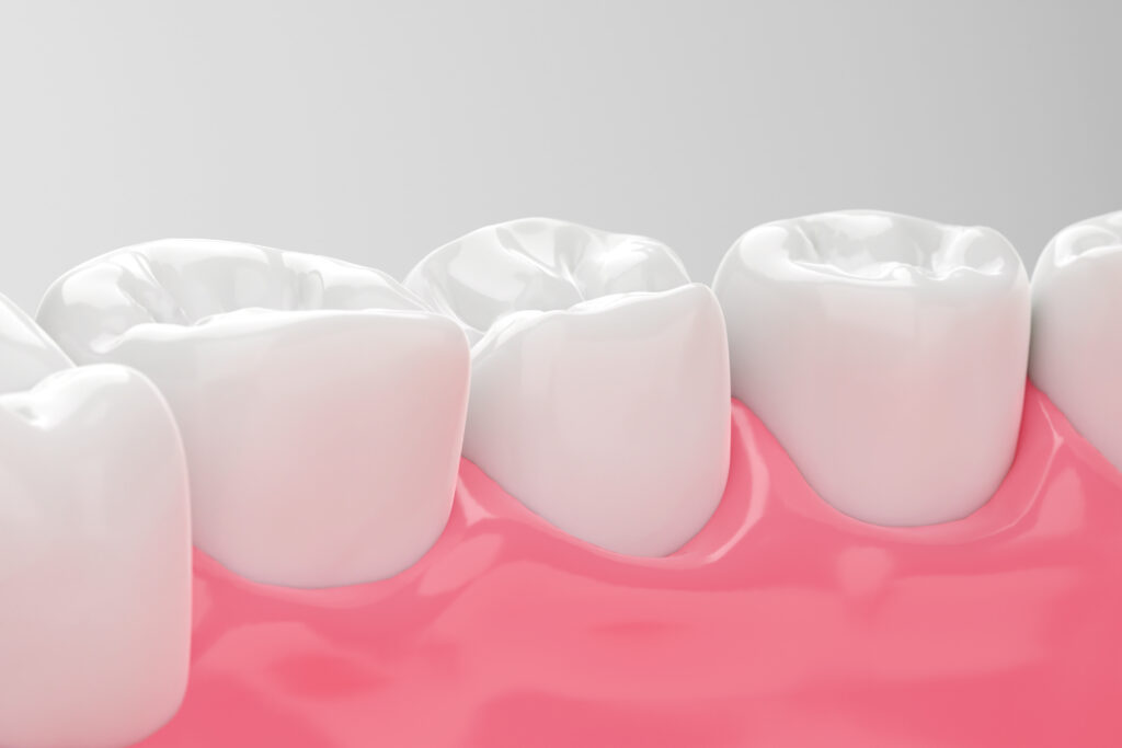 ankeny gum health