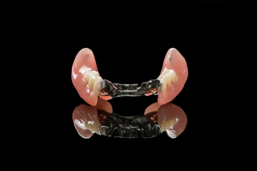 ankeny partial denture