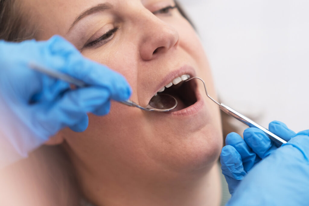 ankeny dental checkup