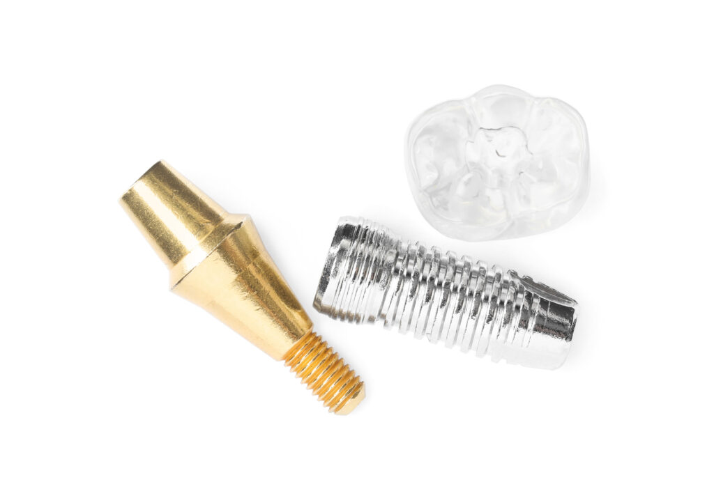 ankeny dental implants