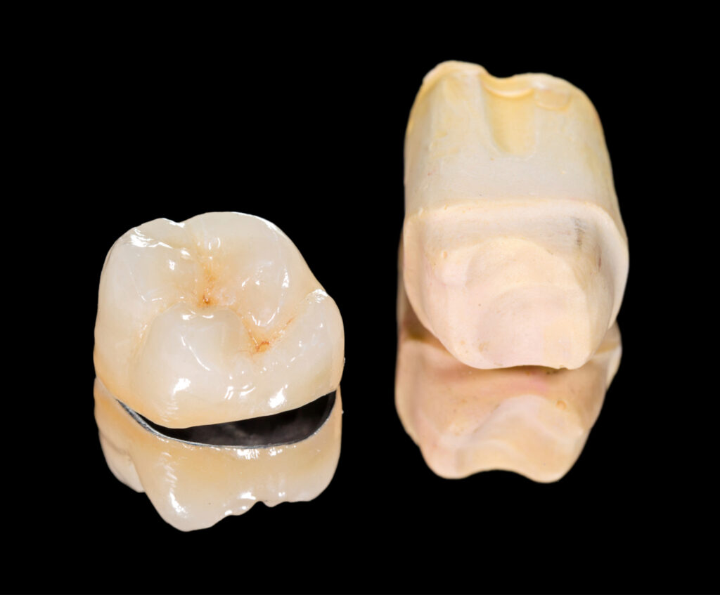 ankeny restorative dentistry
