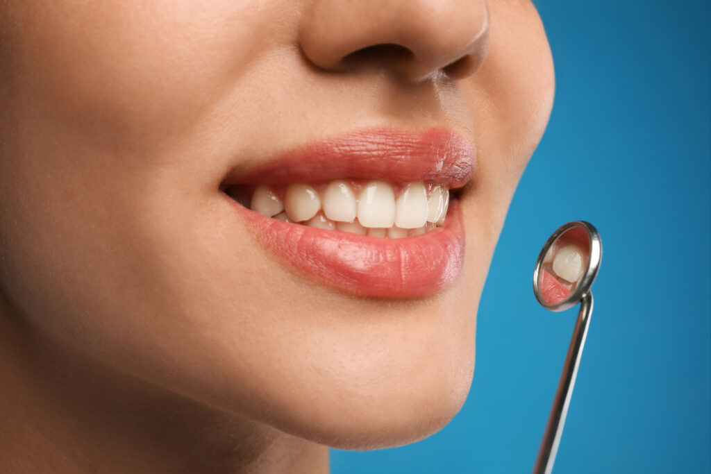 ankeny dental checkup