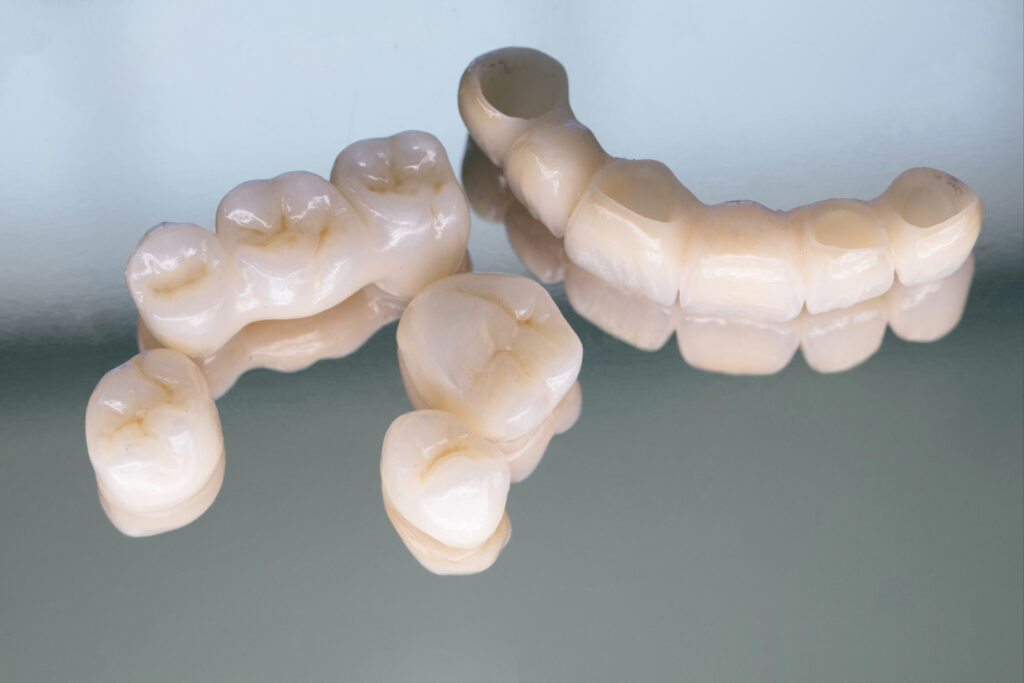 ankeny restorative dentistry