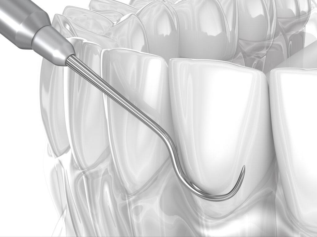 ankeny dental checkup