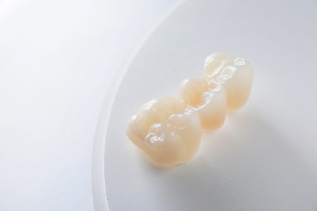 ankeny dental bridge