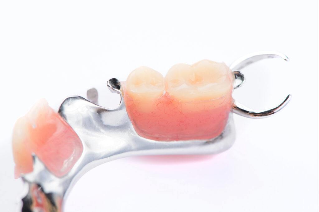 anleny partial dentures