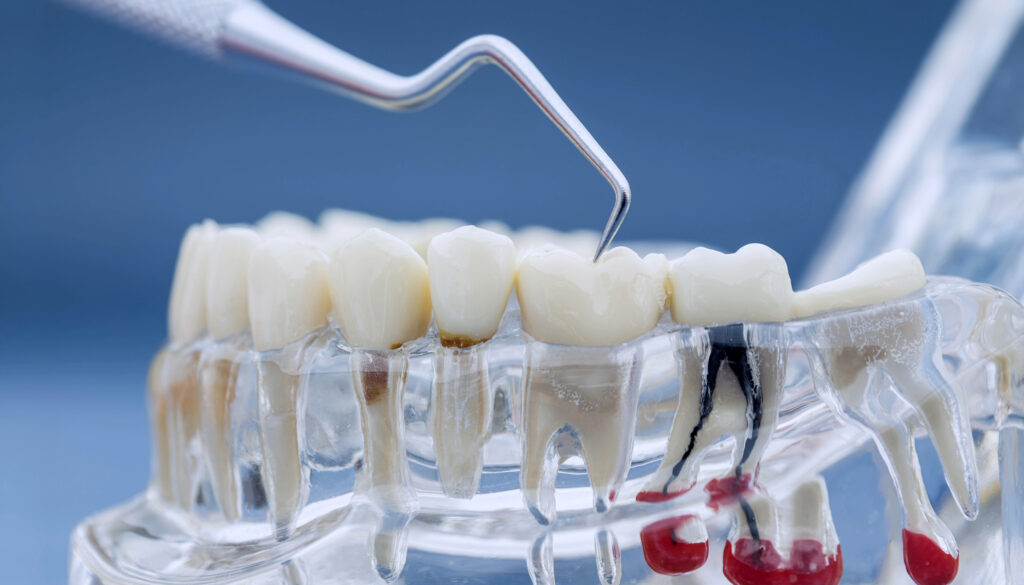 ankeny restorative dentistry