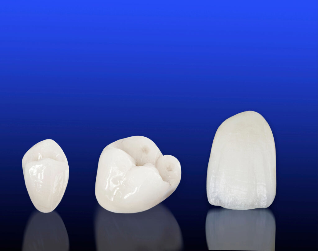 ankeny crowns