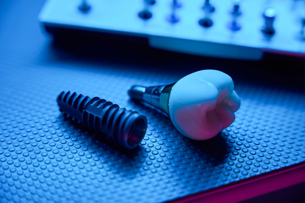 ankeny dental implants