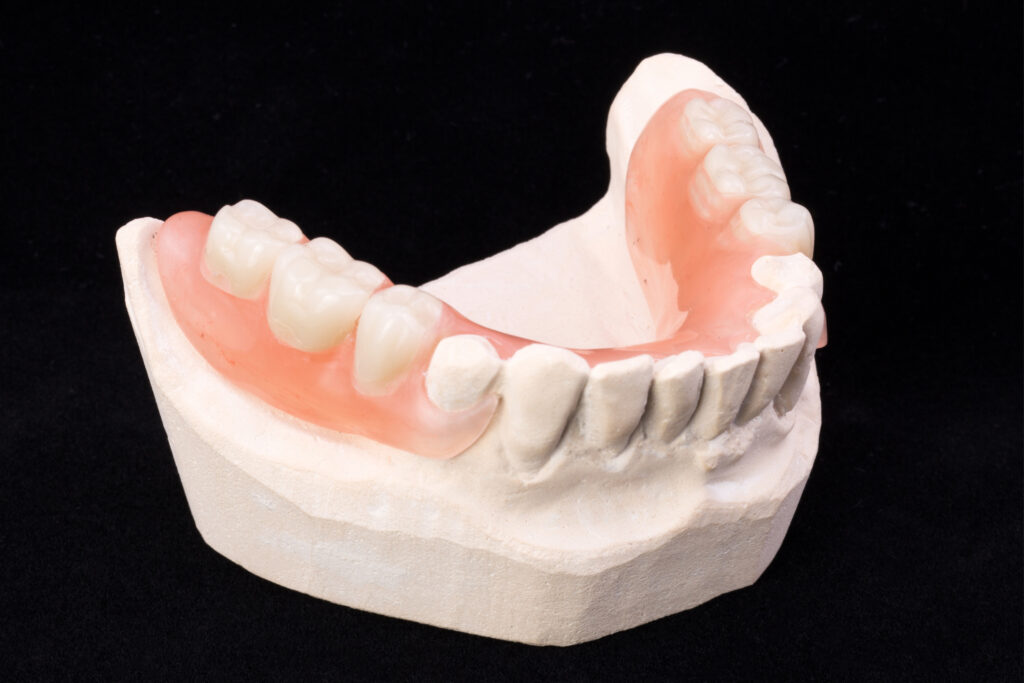 ankeny partial dentures