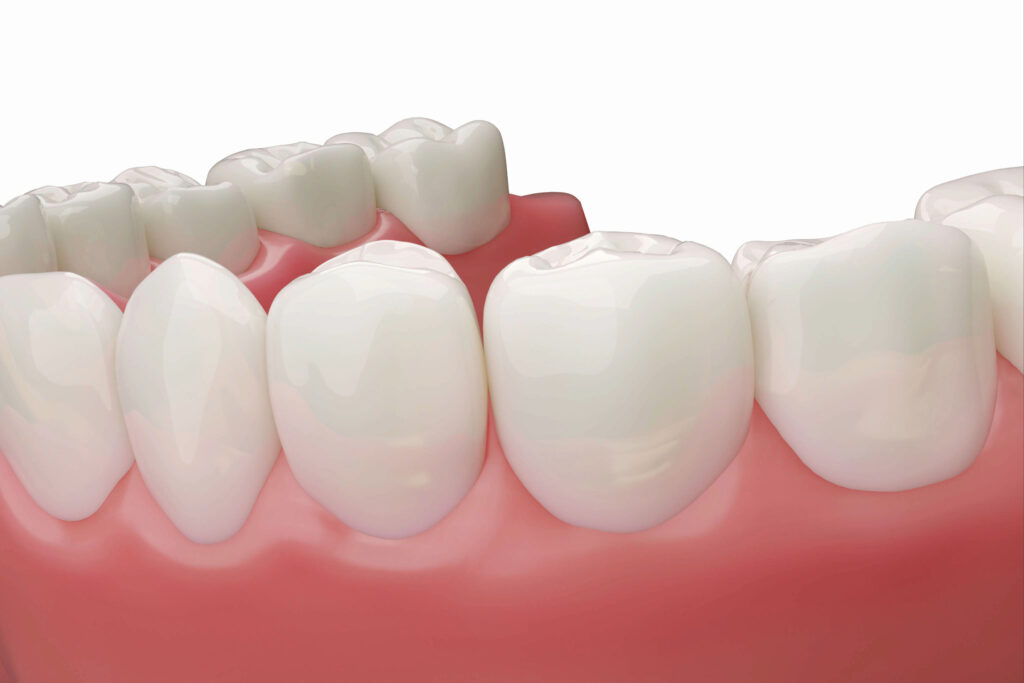 ankeny periodontal health