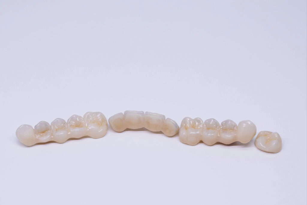 ankeny dental bridge