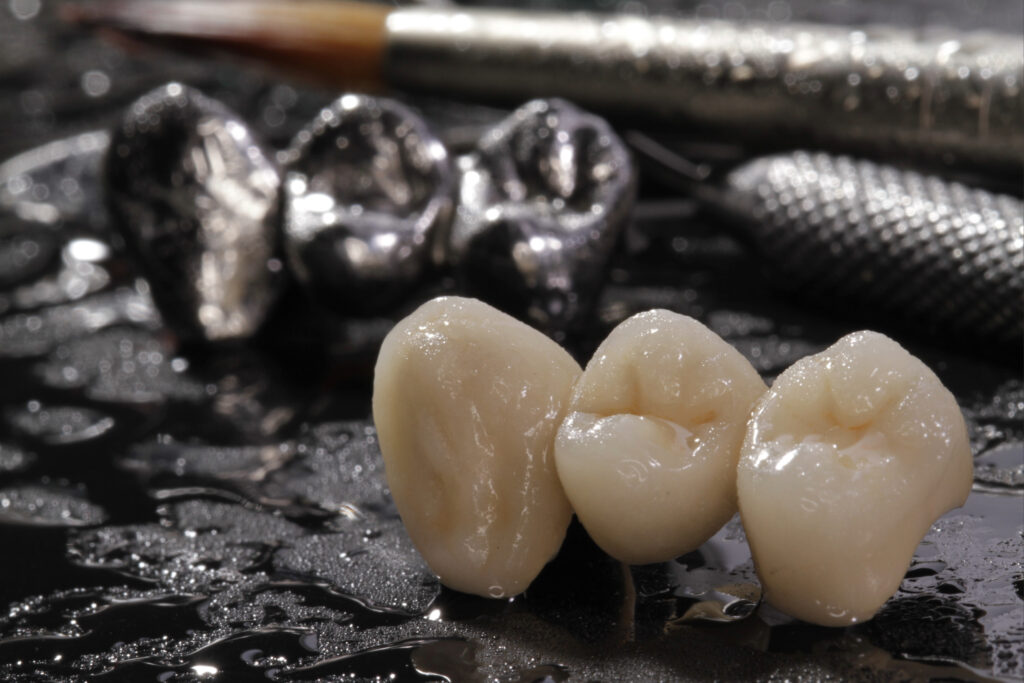 ankeny dental crowns