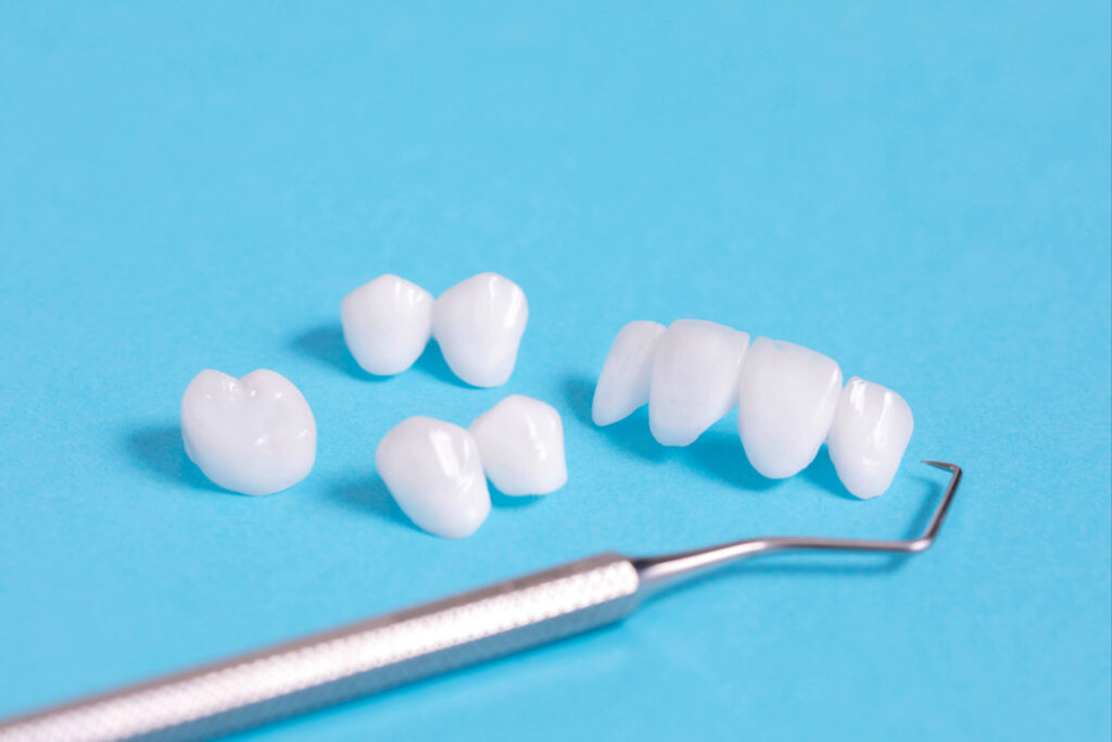 ankeny dental bridge