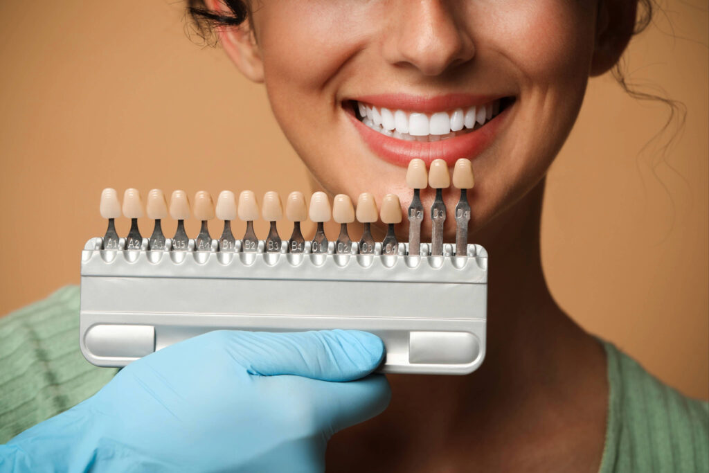 ankeny teeth whitening